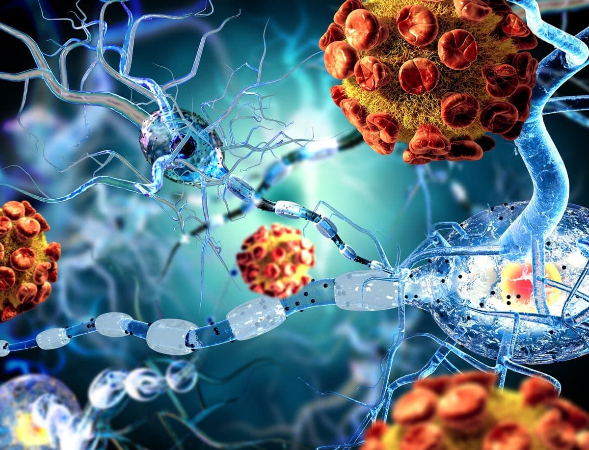 3D Signatures’ TeloView™ Software identifiziert und stadiiert Patienten mit Alzheimer-Krankheit anhand eines Wangenabstrichs